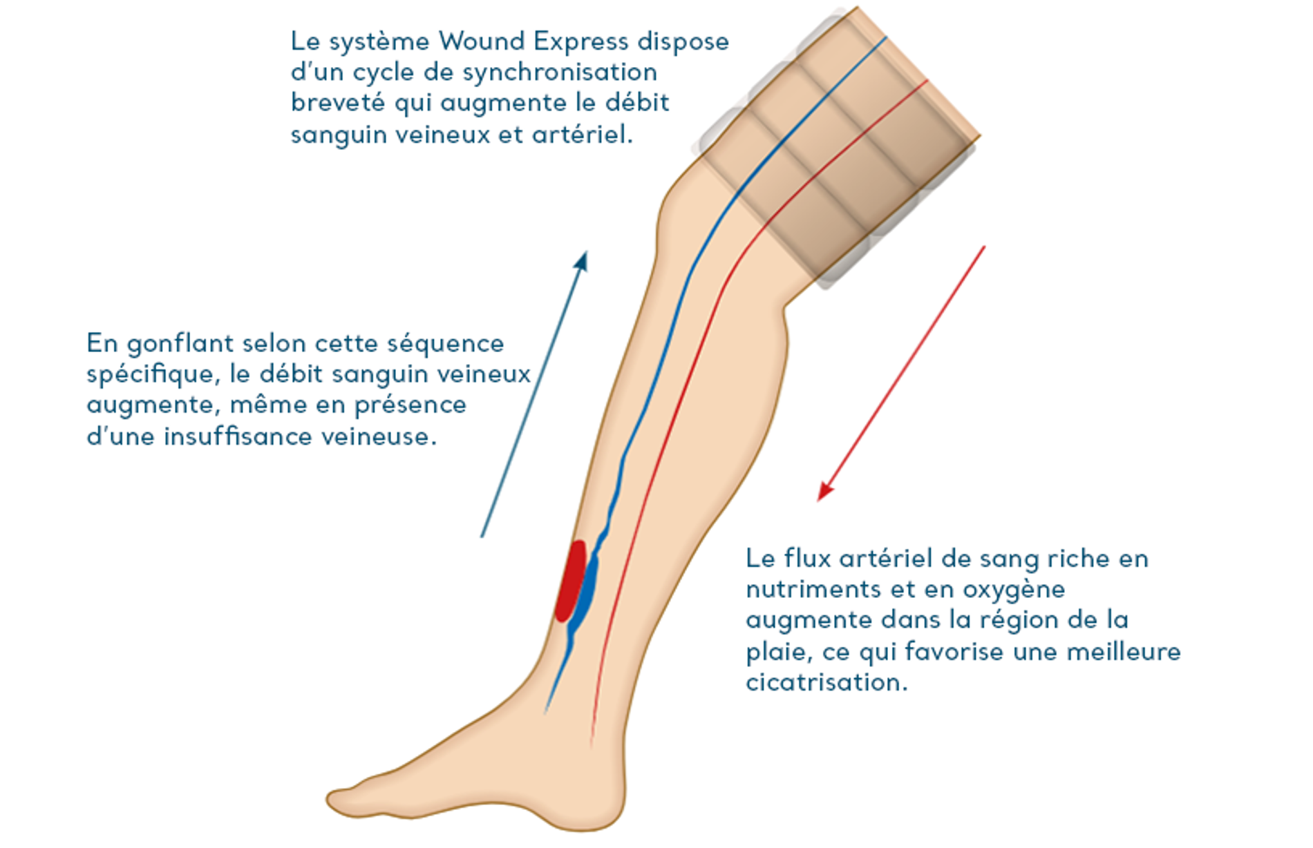 Schéma du système du WoundExpress