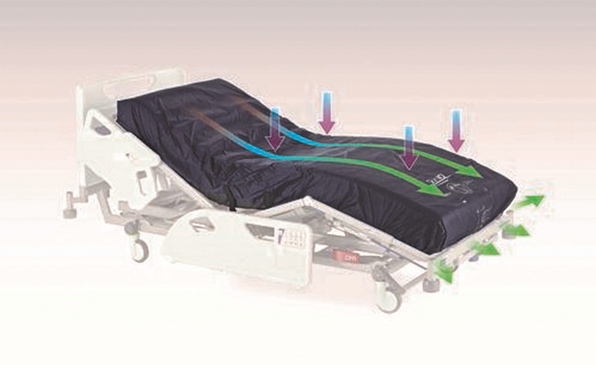 Schéma Matelas anti escarres pour la gestion du microclimat et de la redistribution de la pression chez les patients obèses