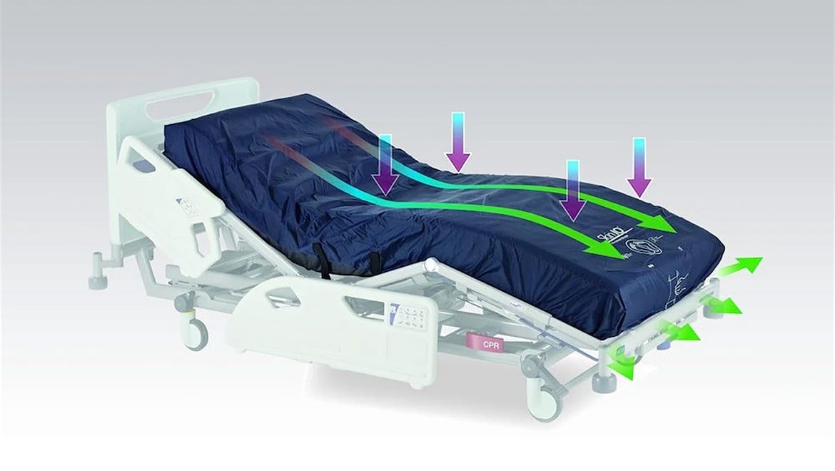 The International Pressure Ulcer Prevention and Management Guidelines discuss how managing microclimate can provide an environment conducive to injury prevention and tissue repair. As such the guidelines recommend the need for additional features such as the ability to control moisture and temperature when selecting a support surface.