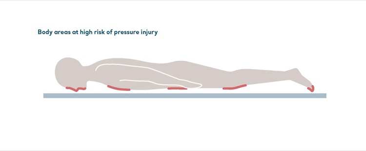 Pressure injury risk | Arjo