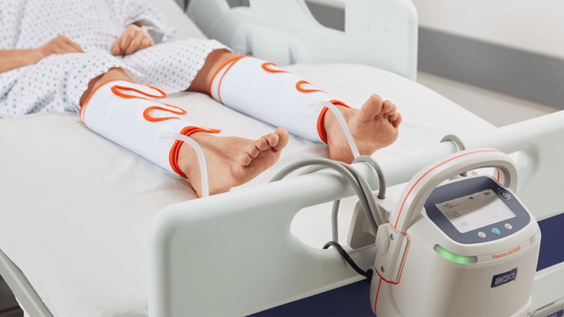 Prévention de la thrombo-embolie veineuse (TEV) grâce à la CPI - Comment la mettre en place et que recommandent les médecins ?