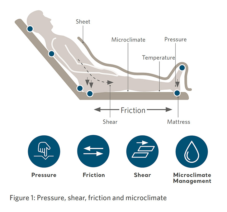 blog.bmc-friction-shear.img-v2.jpg