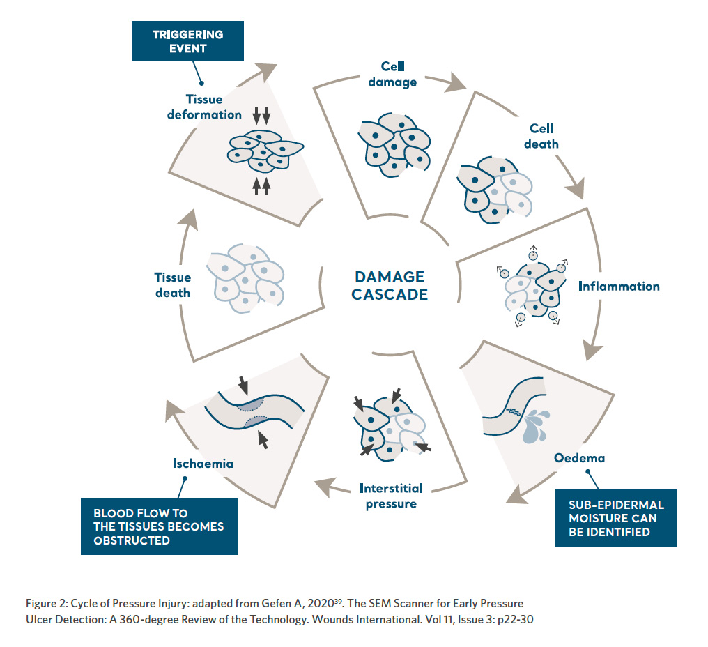 blog.summary-prolonged.cycle-of-pressure-injury.img.jpg